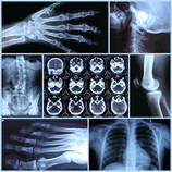 Röntgenbilder und CT-Bilder sind für die Diagnostik nötig.
