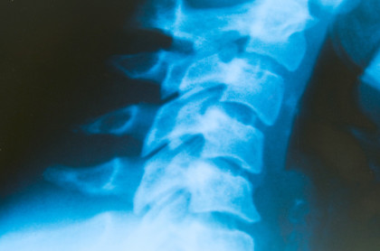 Rückenschmerzen müssen oft nicht sein! Wir sind spezialisiert auf den Bewegungsapparat.